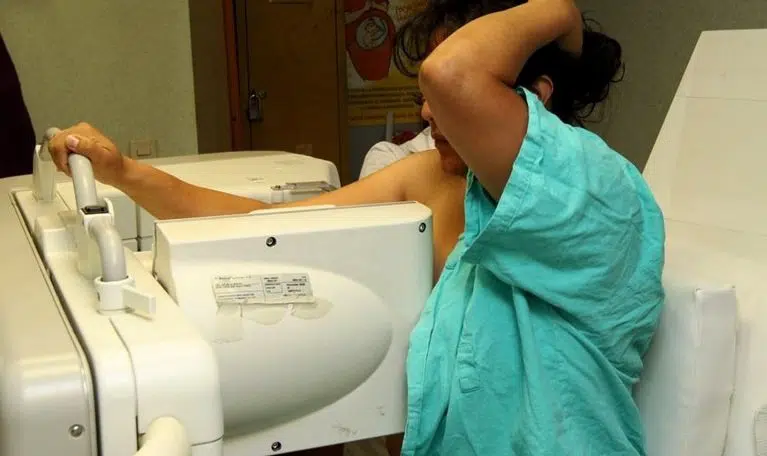 Sanitas pagará 192.000 euros a una mujer mal diagnosticada de cáncer de mama