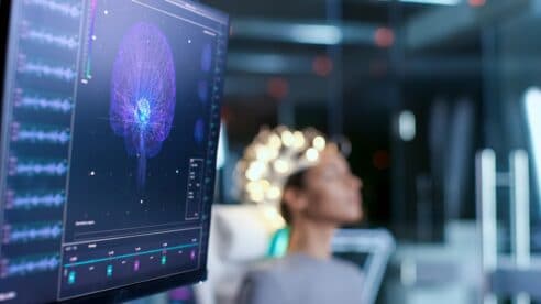 Luces y sombras de la neurociencia: Los neuroderechos