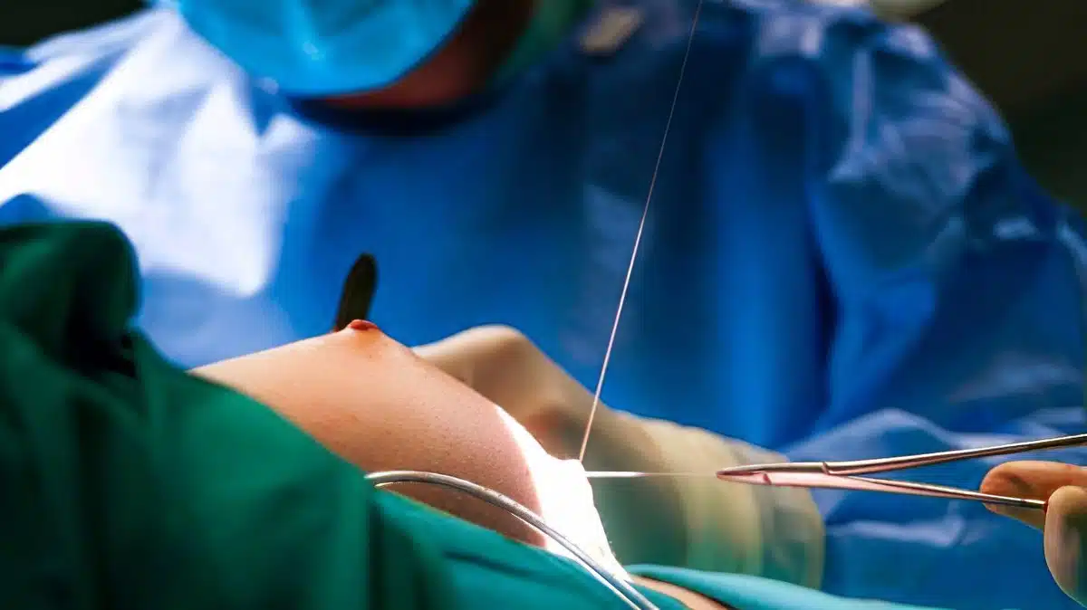 La supuesta mala praxis en un implante de pecho acaba con una querella en los tribunales contra un cirujano plástico