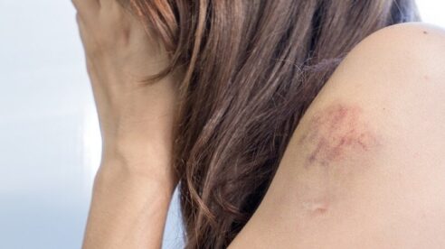 Un joven, condenado a 6 meses de prisión por agredir e insultar a una menor trans a la salida del instituto