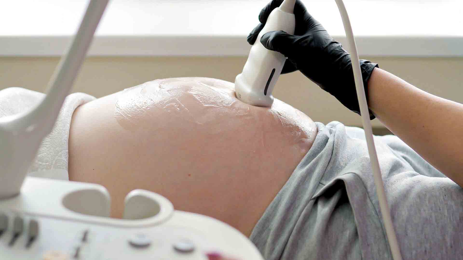 Los nacidos también tienen que tener derecho a una indemnización por diagnóstico prenatal erróneo