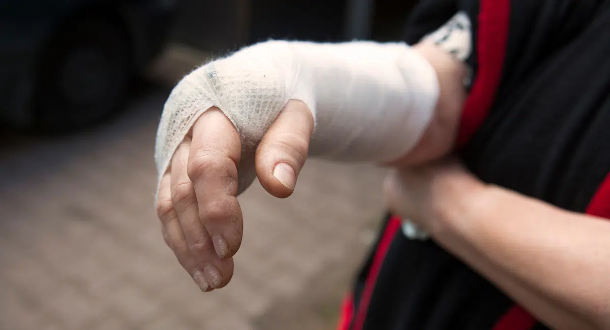 Despedir a una trabajadora tras romperse la mano es nulo, y no improcedente
