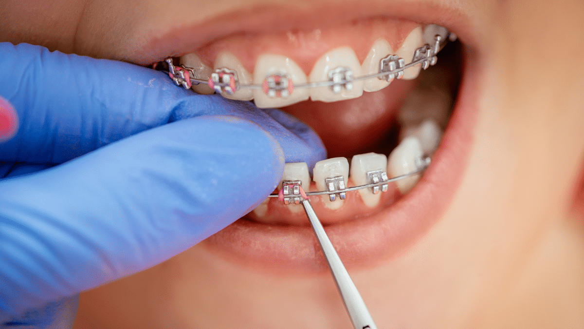 Una clínica dental, condenada a pagar 54.000 euros a una joven por los problemas que le causó una mala ortodoncia